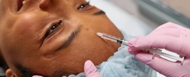 Exosomes With Microneedling