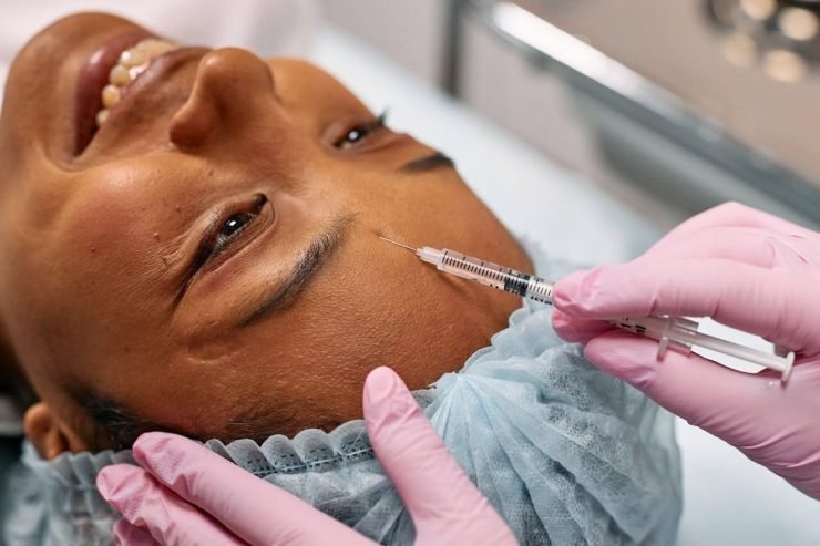 Exosomes With Microneedling